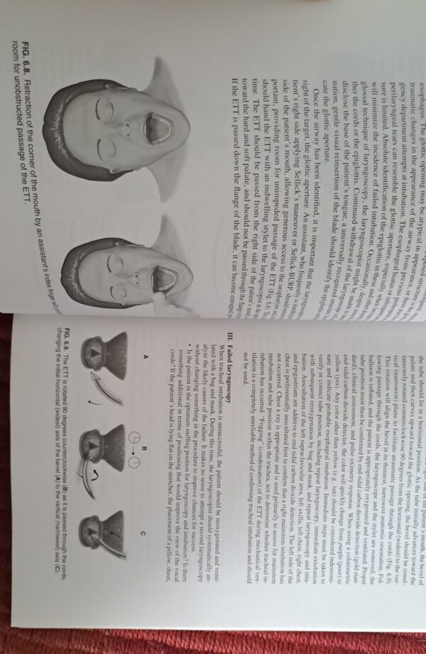 Manual Of Emergency Airway Management – Ron M. Walls secondhand book